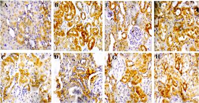 Mitigative role of cysteamine against unilateral renal reperfusion injury in Wistar rats